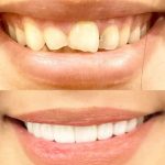 دکتر احمد تیموری در دزفول