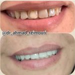 دکتر احمد تیموری در دزفول