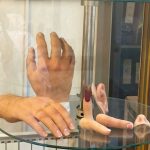 کلینیک ارتوپدی فنی دایار در تهران