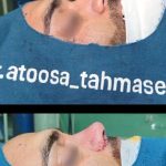 دکتر آتوسا طهماسبی در خرم آباد