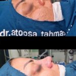 دکتر آتوسا طهماسبی در خرم آباد