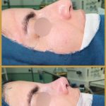 دکتر آتوسا طهماسبی در خرم آباد