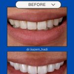 دکتر کاظم هادی در تهران