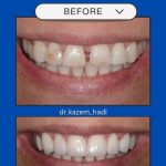 دکتر کاظم هادی در تهران