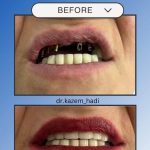 دکتر کاظم هادی در تهران