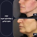 دکتر مهدی رضائی در مشهد