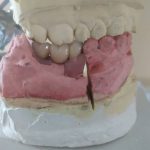 دندانساز قاسمی در سید خندان تهران