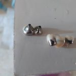 دندانساز قاسمی در سید خندان تهران