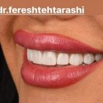 دکتر فرشته تراشی در تهران