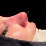 دکتر سونیا صادق جراحی زیبایی بینی در اردبیل