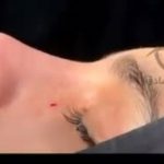 دکتر سونیا صادق جراحی زیبایی بینی در اردبیل