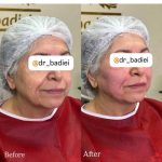 دکتر سارا بدیعی در تهران