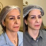 دکتر سارا بدیعی در تهران