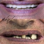 دکتر میثم ملک زاده در بندر انزلی