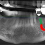 دکتر محمد ابراهیم حاجی آقاتبار در بابل