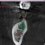 دکتر محمد ابراهیم حاجی آقاتبار در بابل