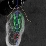 دکتر محمد ابراهیم حاجی آقاتبار در بابل