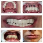 دکتر علیرضا نزهتی در رشت