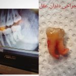 دکتر علیرضا نزهتی در رشت