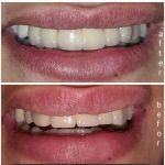 دکتر علیرضا نزهتی در رشت