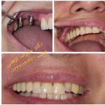 دکتر علیرضا نزهتی در رشت