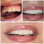 دکتر علیرضا نزهتی در رشت