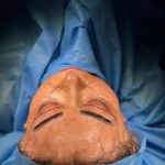 دکتر مهدی حاجی زاده فوق تخصص جراحی پلاستیک در تهران