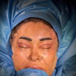 دکتر مهدی حاجی زاده فوق تخصص جراحی پلاستیک در تهران