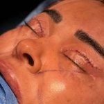 دکتر مهدی حاجی زاده فوق تخصص جراحی پلاستیک در تهران