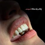 بهترین مرکز تخصصی ایمپلنت در بندرعباس