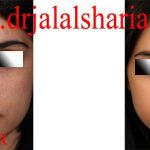 دکتر جلال الدین شریعت در اصفهان