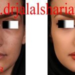 دکتر جلال الدین شریعت در اصفهان