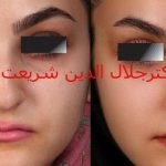 دکتر جلال الدین شریعت در اصفهان