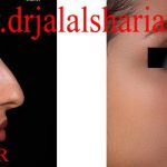 دکتر جلال الدین شریعت در اصفهان