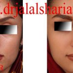 دکتر جلال الدین شریعت در اصفهان