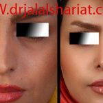 دکتر جلال الدین شریعت در اصفهان