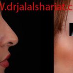 دکتر جلال الدین شریعت در اصفهان