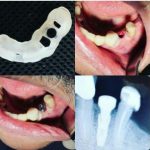 دکتر امیر هوشنگ رسولی نژاد دندانپزشک در کرج