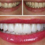 دکتر امیر هوشنگ رسولی نژاد دندانپزشک در کرج