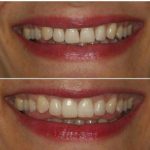 دکتر امیر هوشنگ رسولی نژاد دندانپزشک در کرج