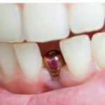 دکتر امیر هوشنگ رسولی نژاد دندانپزشک در کرج