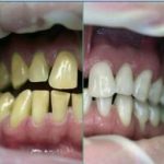 دکتر امیر هوشنگ رسولی نژاد دندانپزشک در کرج