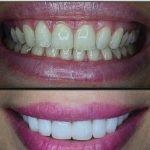 دکتر امیر هوشنگ رسولی نژاد دندانپزشک در کرج