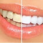 دکتر امیر هوشنگ رسولی نژاد دندانپزشک در کرج