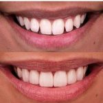 دکتر امیر هوشنگ رسولی نژاد دندانپزشک در کرج