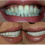 دکتر امیر هوشنگ رسولی نژاد دندانپزشک در کرج