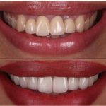 دکتر امیر هوشنگ رسولی نژاد دندانپزشک در کرج