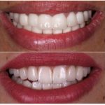 دکتر امیر هوشنگ رسولی نژاد دندانپزشک در کرج