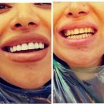 دکتر امیر هوشنگ رسولی نژاد دندانپزشک در کرج