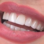 دکتر بهاره عشقی در تهران